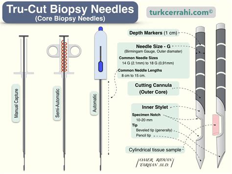 Tru Cut Needle Biopsy | Medical Dictionary