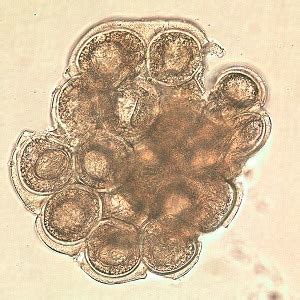 CDC - DPDx - Dipylidium caninum