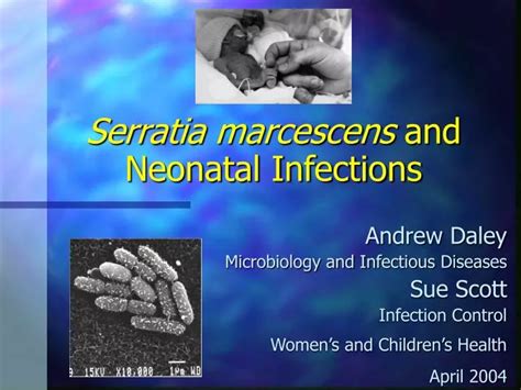 PPT - Serratia marcescens and Neonatal Infections PowerPoint ...