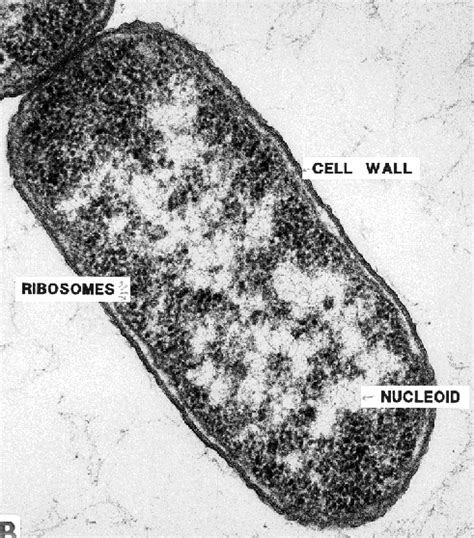 More on Bacterial Morphology