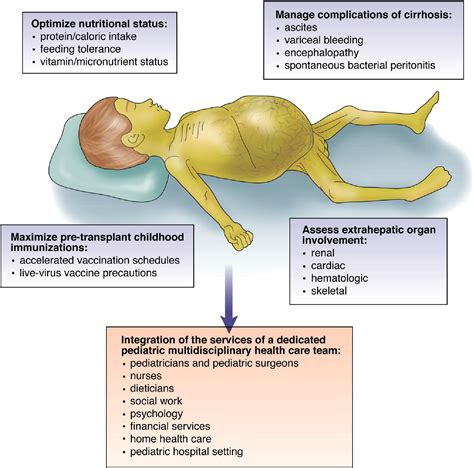 End Stage Liver Disease Concept Map - United States Map