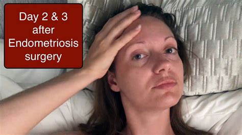 Laparoscopy Surgery for Endometriosis - Day 2 & 3 (Jun 2018) - YouTube