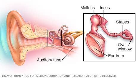 Slide show: How you hear - Mayo Clinic