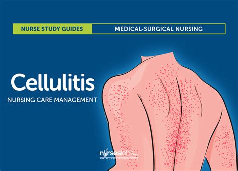 Cellulitis Pathway