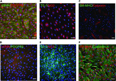 High expression levels of cardiac pericyte markers but no smooth muscle ...