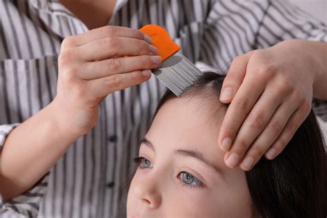 Treating and Preventing Head Lice In Children - Elite Hospital Kingwood