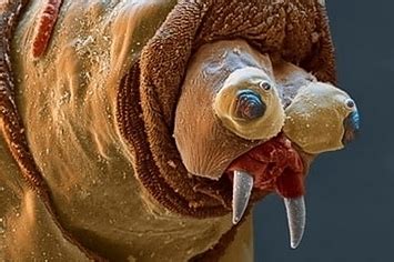 26 Things You Never Want To See Under A Microscope