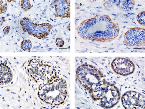 Immunohistochemical expression pattern of myoepithelial cell markers in ...