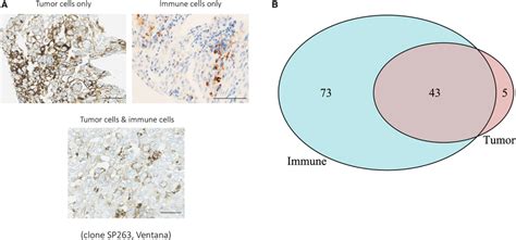 PD‐L1 protein expression patterns in BC cohort 1. (A) Areas of PD‐L1 ...