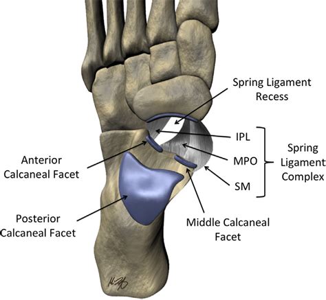 Illustration of the normal anatomy of the spring ligament complex. From ...