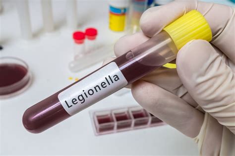 Legionella Treatment Clearwater | R2J