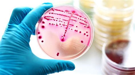 The Different Types of Streptococci (Strep Bacteria) | Christ Memorial