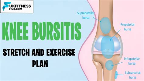 Stop Knee Bursitis Pain: Prepatellar, Pes Anserine, Infrapatellar And Suprapatellar Bursitis ...