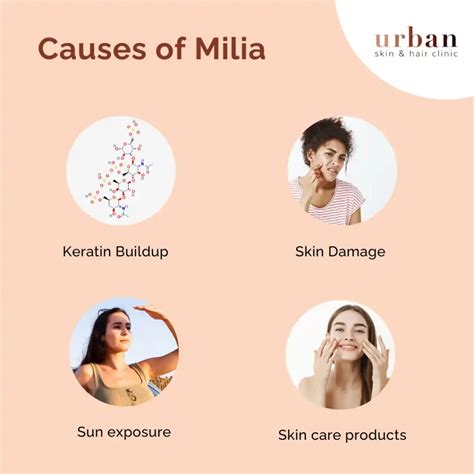 Milia Types, Causes, Symptoms & Treatment | USHC