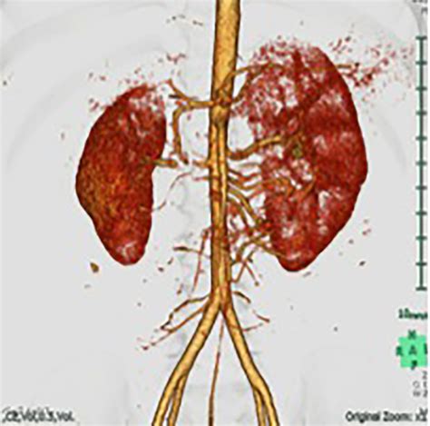 J Med Cases