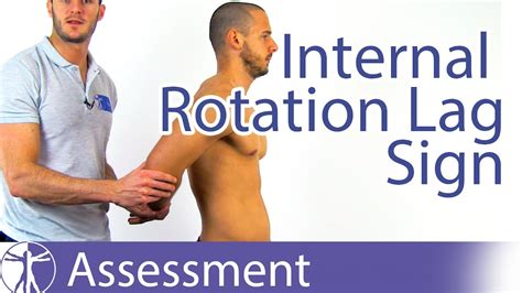 Internal Rotation Lag Sign | Subscapularis Tear - YouTube