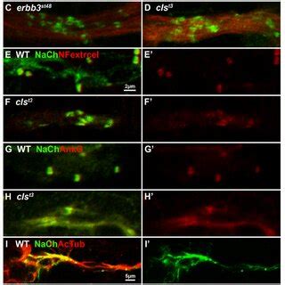 In the absence of Schwann cells, peripheral axons form aberrant ...