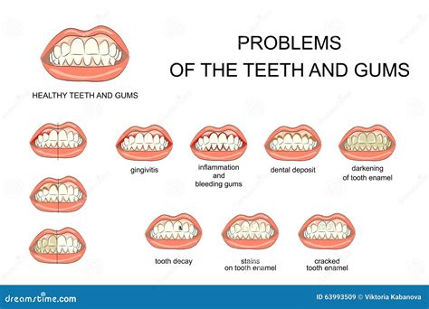 Problems Of The Teeth And Gums Stock Vector - Image: 63993509