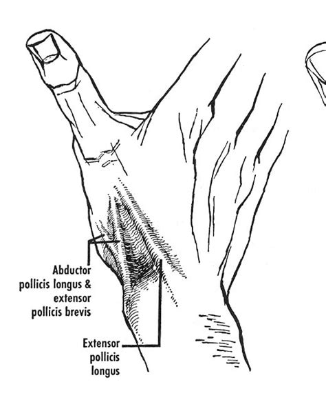 Dr.DV's PGMEE Notes: Anatomical Snuff Box