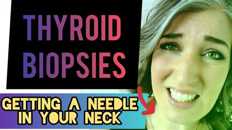 Thyroid nodule biopsy: From diagnosis to outcomes - YouTube