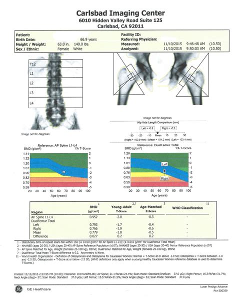 Bone Densitometry/DEXA scan - Carlsbad Imaging Center - Imperial Radiology