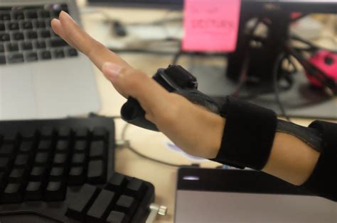 My experience with Carpal Tunnel Syndrome