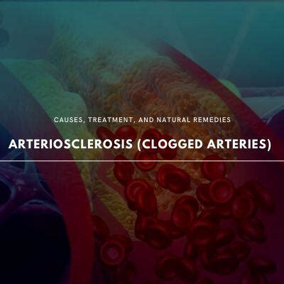 Understanding Arteriosclerosis: Causes, Symptoms, and Natural Remedies