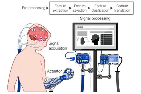 NEURO: Bleak Cyborg Future From Brain-Computer Interfaces if We’re Not ...