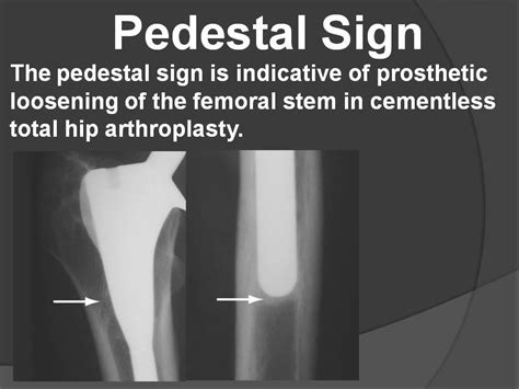 PEDESTAL SIGN - Radiology Classroom