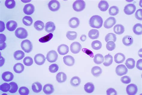 Plasmodium falciparum - Wikipedia