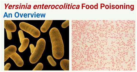 Yersinia enterocolitica Food Poisoning (Yersiniosis)