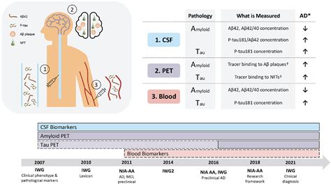 DIAGNOSTIC BIOMARKERS OF AMYLOID AND TAU PATHOLOGY IN ALZHEIMER’S DISEASE: AN OVERVIEW OF TESTS ...