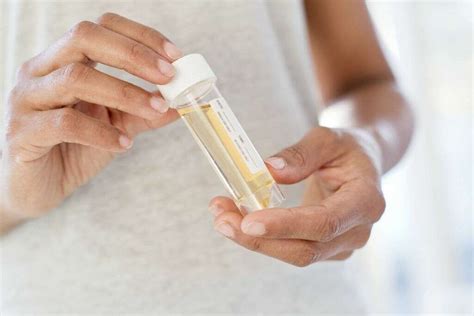 Cloudy Urine: 10 Causes of Cloudy Urine