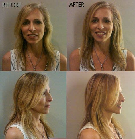 Argan Oil for Face Before and After Pictures – Seeing it Work | Argan ...