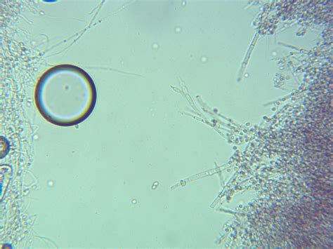 Can anyone identify Paecilomyces lilacinus?