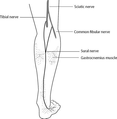 Sural Nerve Tibial Nerve