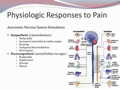 PPT - Prehospital Pain Assessment and Management PowerPoint ...