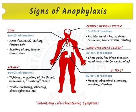 Signs And Symptoms Of Anaphylaxis Anaphylactic Shock Anaphylaxis | Hot Sex Picture