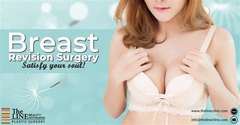 Breast revision surgery – Artofit