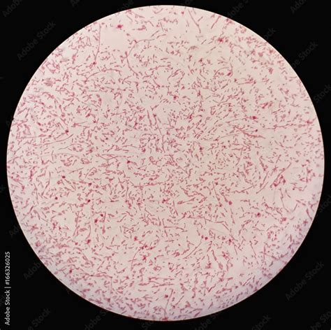 Smear of gram negative bacilli bacteria under 100X light microscope ...