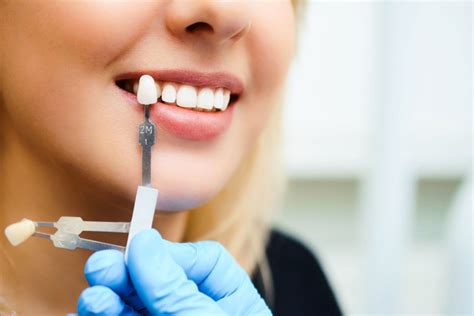 Are There Whitening Side Effects? - Dentist in Marshall, TX