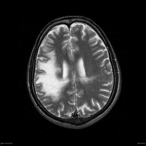 Pin on Neurorad