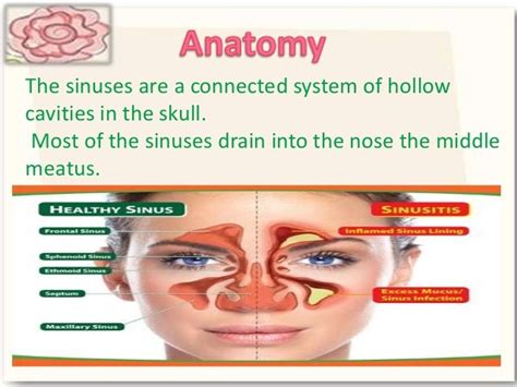 Fungal sinusitis