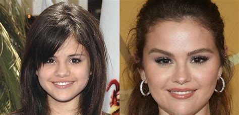 Top 4 selena gomez before and after best, don't miss - BSS news