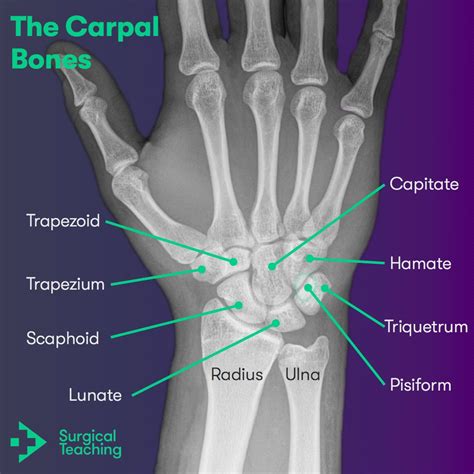 Carpal Bone Mnemonic And Names: Wrist Anatomy Made Easy —, 49% OFF