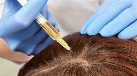 The 3 Most Effective Hair Loss Treatments and How To Use Them - Vera Clinic