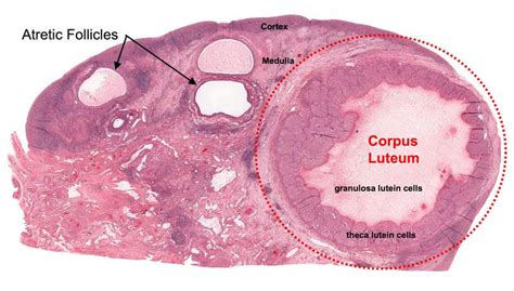 Ovary (c.s.) | Corpus luteum, Ovaries, Lutein