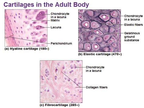 Cartilage and Bones | Hyaline cartilage, Collagen fibers, Human anatomy and physiology