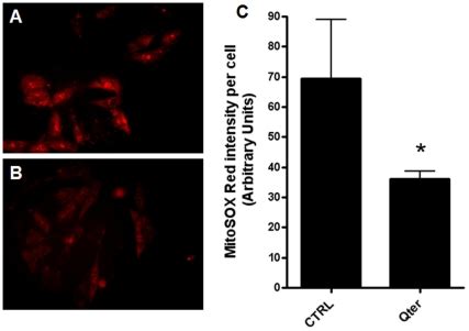 The representative fluorescence images showed the oxidized MitoSOX ...