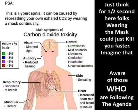 Hypercapnia | Carbon dioxide, Carbon, Memes